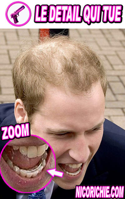 Le prince william me laisse bouche bee r7xb8z - Eugenol