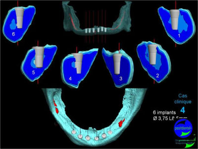 Mcd mise en charge diff r e09 c2rkhp - Eugenol