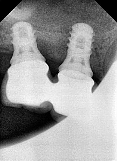 Meg2 llflhv - Eugenol