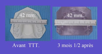 Mesures mqqyrj - Eugenol