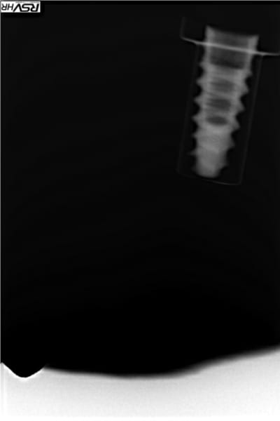 Mis2 es1ken - Eugenol