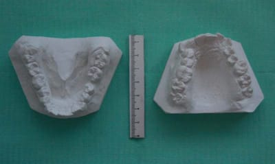 Moulage 1 vlrapq - Eugenol