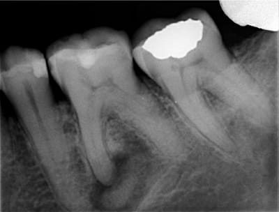 Mpb jrgwob - Eugenol