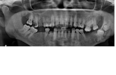 M czfpdt - Eugenol