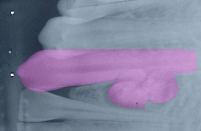 Manuel 1 tetmcs - Eugenol