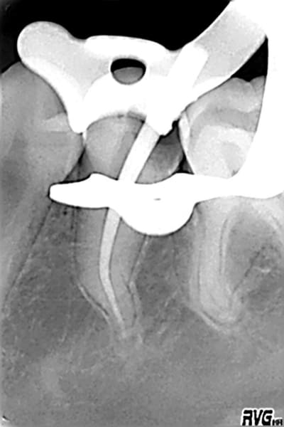 Me2 gbnqi0 - Eugenol