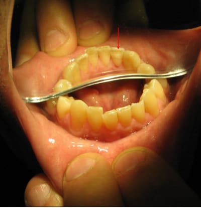 Miam miam w4hgit - Eugenol