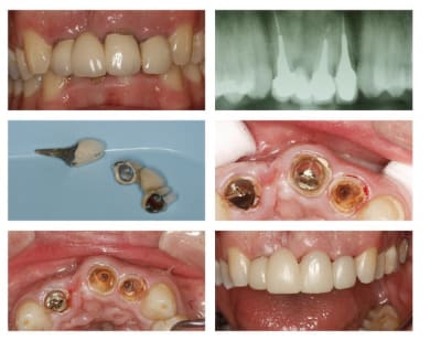 Montage 12 22 small cpdtai - Eugenol