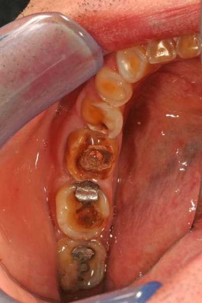 Mr t secteur 3 rdcevn - Eugenol