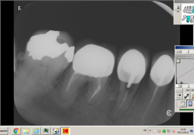 New picture  1  i1s5ud - Eugenol