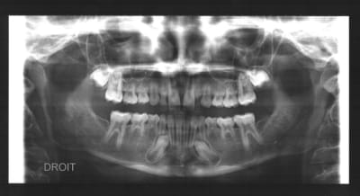 Num ris    02 09 2009 09 36 a5n8mt - Eugenol