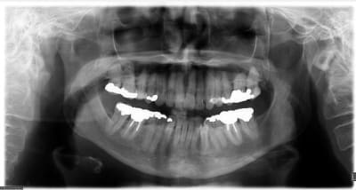 Opg yo6p5p - Eugenol