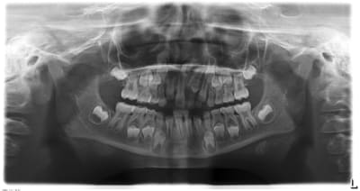 Odontome 21 km81ek - Eugenol