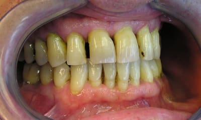 P1010003 zku7fi - Eugenol