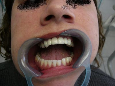 P1010501 kencwq - Eugenol