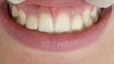 P1010570 aeufl8 - Eugenol