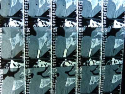 P1050003 iyoiig - Eugenol