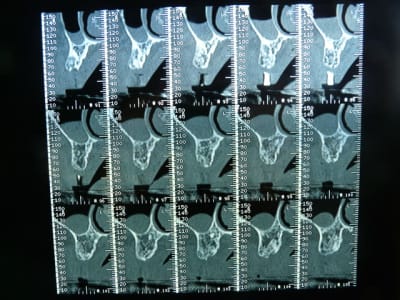 P1050008 mehu4q - Eugenol