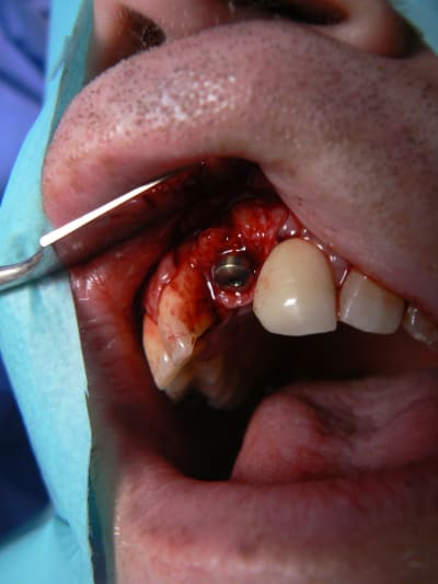 P1090041 ddckwp - Eugenol