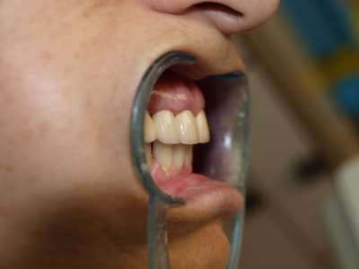 P4050323 kzyfcu - Eugenol