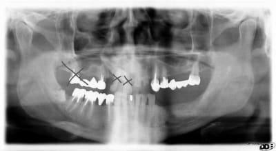 Pano1 tdyeqg - Eugenol
