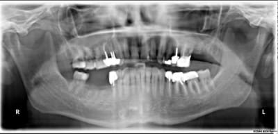 Pano nxxarr - Eugenol