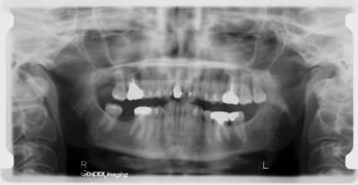Pano panxk3 - Eugenol