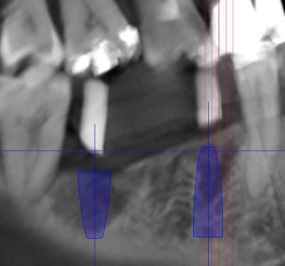 Pano u9k7hm - Eugenol