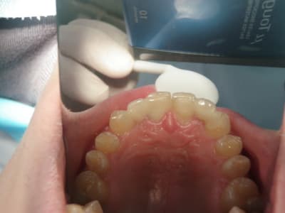 Pc220008 xfltj8 - Eugenol