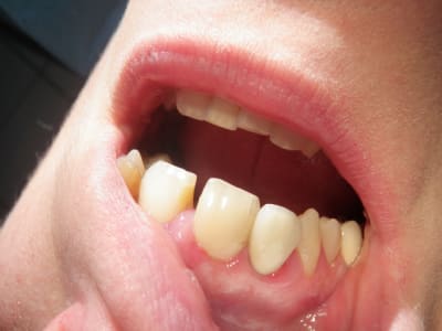 Pc220010 tteab9 - Eugenol