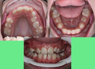 Photos 1 oreje9 - Eugenol