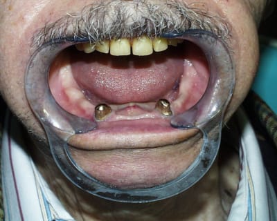 Pic00036 qf2frl - Eugenol