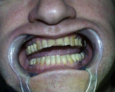 Pic00042 tfwabw - Eugenol