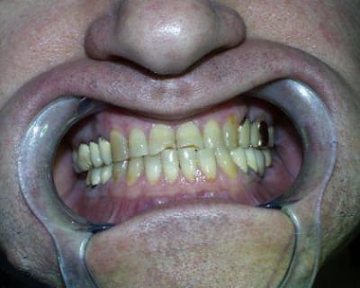 Pic00043 gspu8c - Eugenol