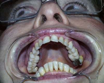 Pic00058 eh643w - Eugenol