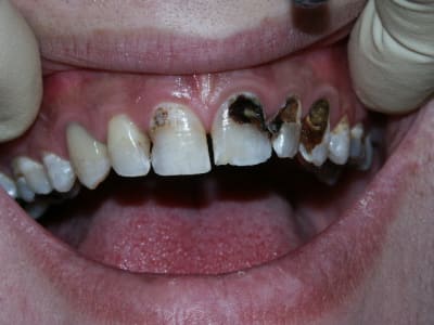 Pict0020 vnuxfp - Eugenol