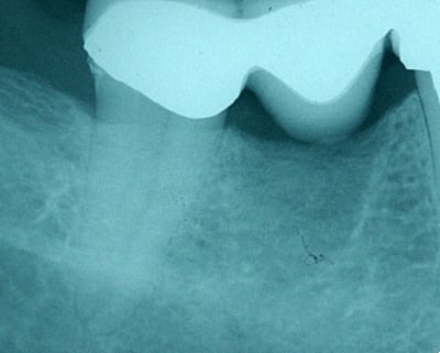 Pict0134 ljkfxo - Eugenol