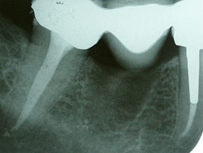 Pict0136 mvbr6x - Eugenol