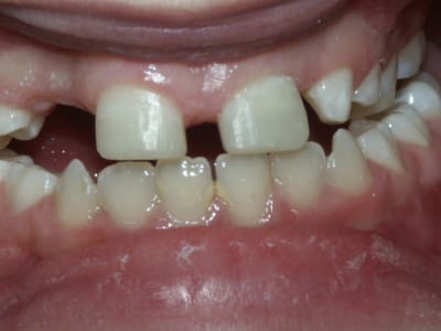 Pict0176 pbzmt5 - Eugenol