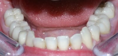 Pict0202 y17syp - Eugenol