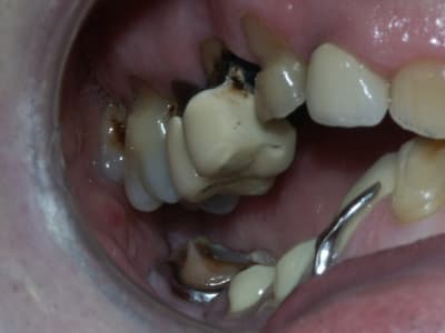 Pict0206 z7vfkc - Eugenol