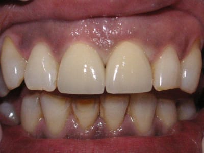 Pict0273 nxewwx - Eugenol