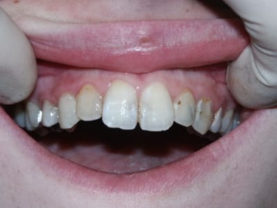 Pict0333 rrzolb - Eugenol