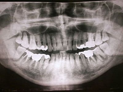 Pict0335 ukiaqu - Eugenol