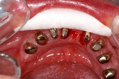 Pict1611 qw5qo0 - Eugenol