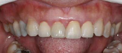 Pose 11  cxplfj - Eugenol