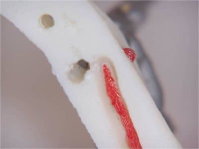 Positdental 7 ksq5u6 - Eugenol