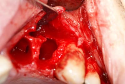 Pre a xxh6mh - Eugenol