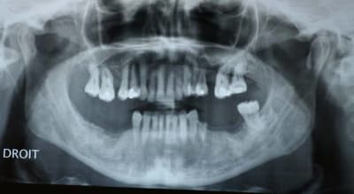 P img 2392 bhn1a4 - Eugenol