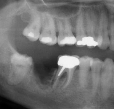 Pano xs ue3ryd - Eugenol